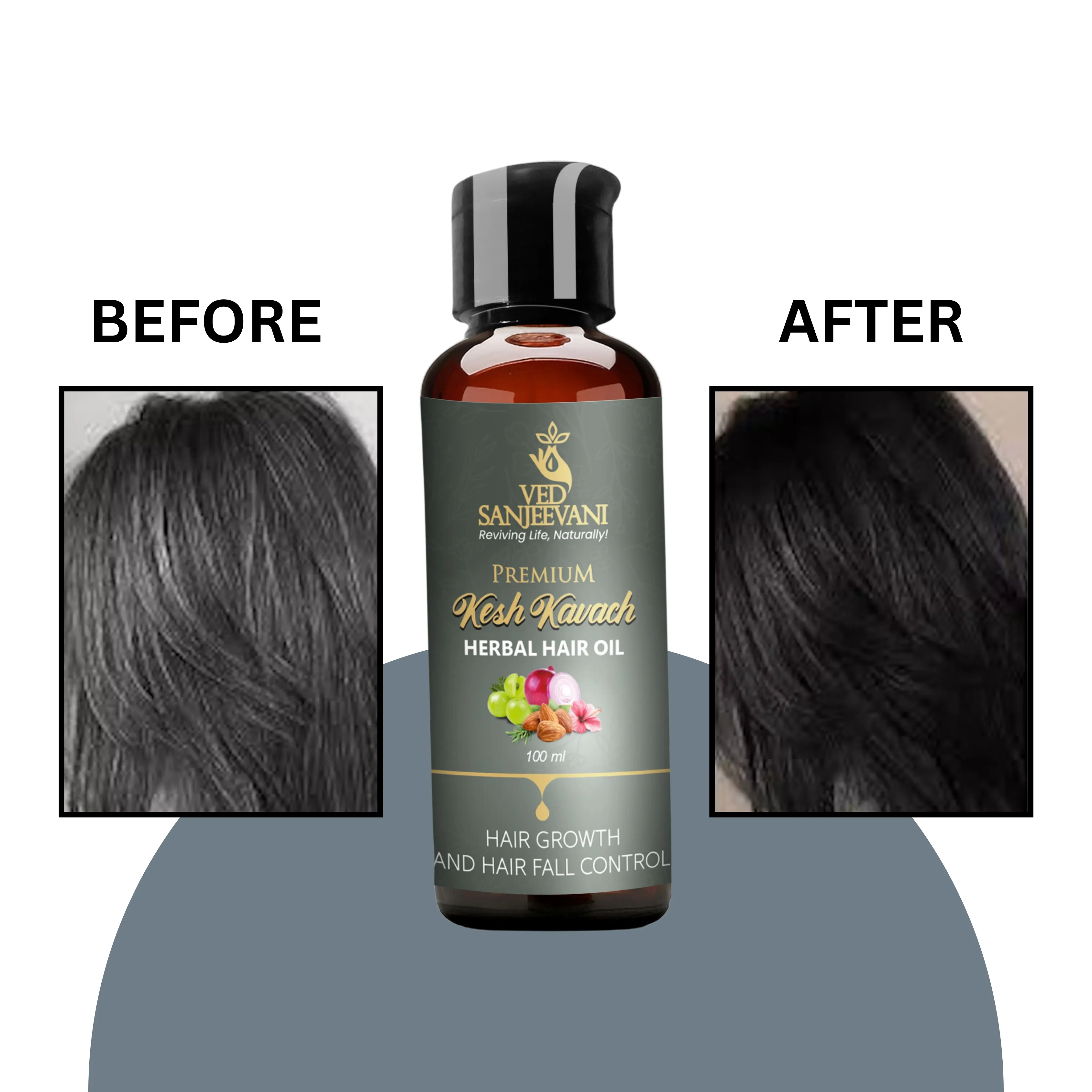 Kesh Kavach Herbal Hair Oil – For Daily Damage Hair - Image 7
