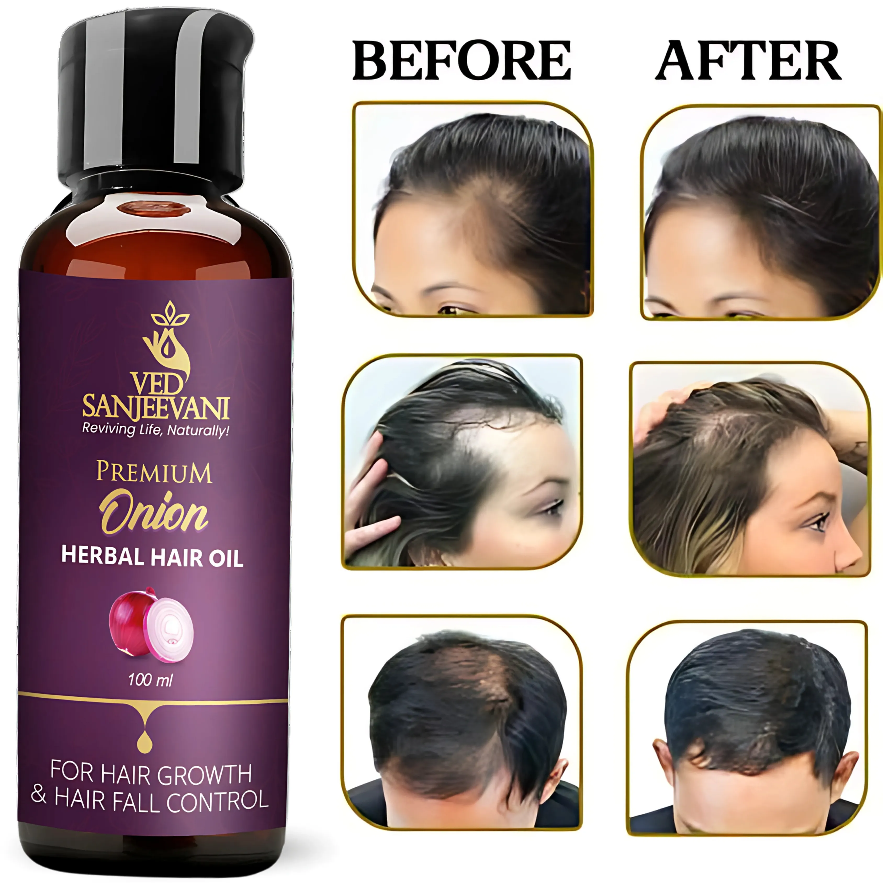 Premium Onion Herbal Hair Oil – Onion & Kalonji for Hair Regrowth - Image 7